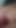 好色な既婚ふしだらな女の深いフィスト後のサプライズアナル | クリップ 1