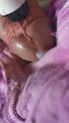 Pregled videozapisa