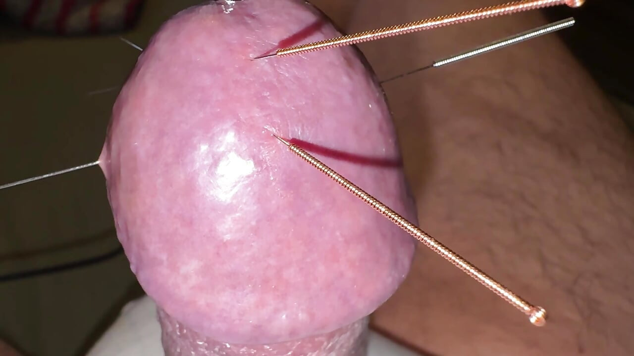 Acupuncture - Orgasm!