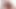 Lizzy Yum SD August 2025 Dilating #50