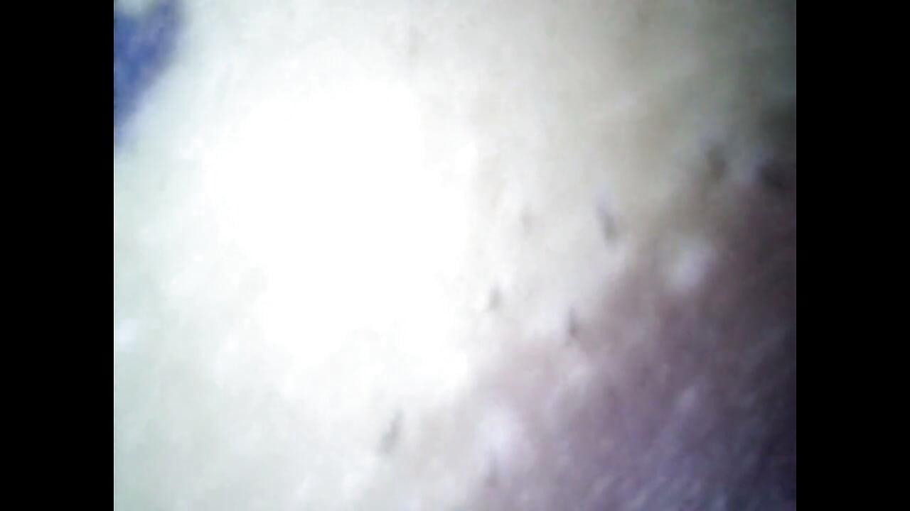 Endoscope Details - Hole Balls Cock Foreskin Belly Nipples Mouth Sperm