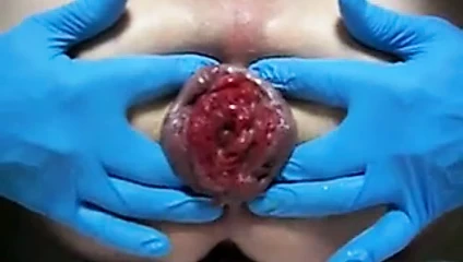 Şişe yapay penis ve esneme