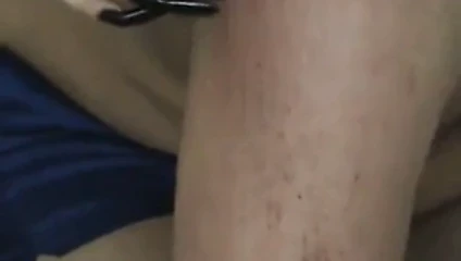 razor sharp nails scratching