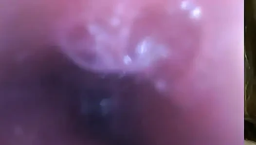 Endoskopi!! Giantess Menelan 25 Anggota Sekali lagi