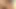 Masturbating Phimosis Cock