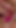 Key moment from "Dillator Insertion in his Dick Ecstasy - 577"