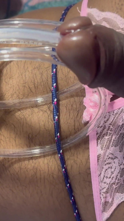 ท่อปัสสาวะน้ําแตก คลิป 1