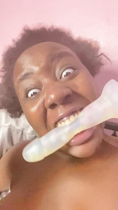 StoryTime + bartholin Zysten-Update - ich brauche einen Arzt, der dabei hilft