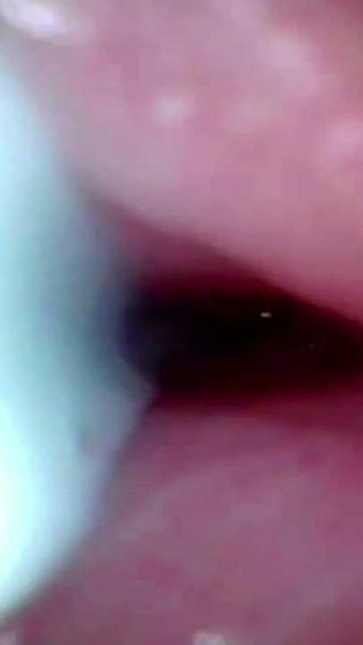 The camera in the penis shows the best picture of the male orgasm event | Clip 1