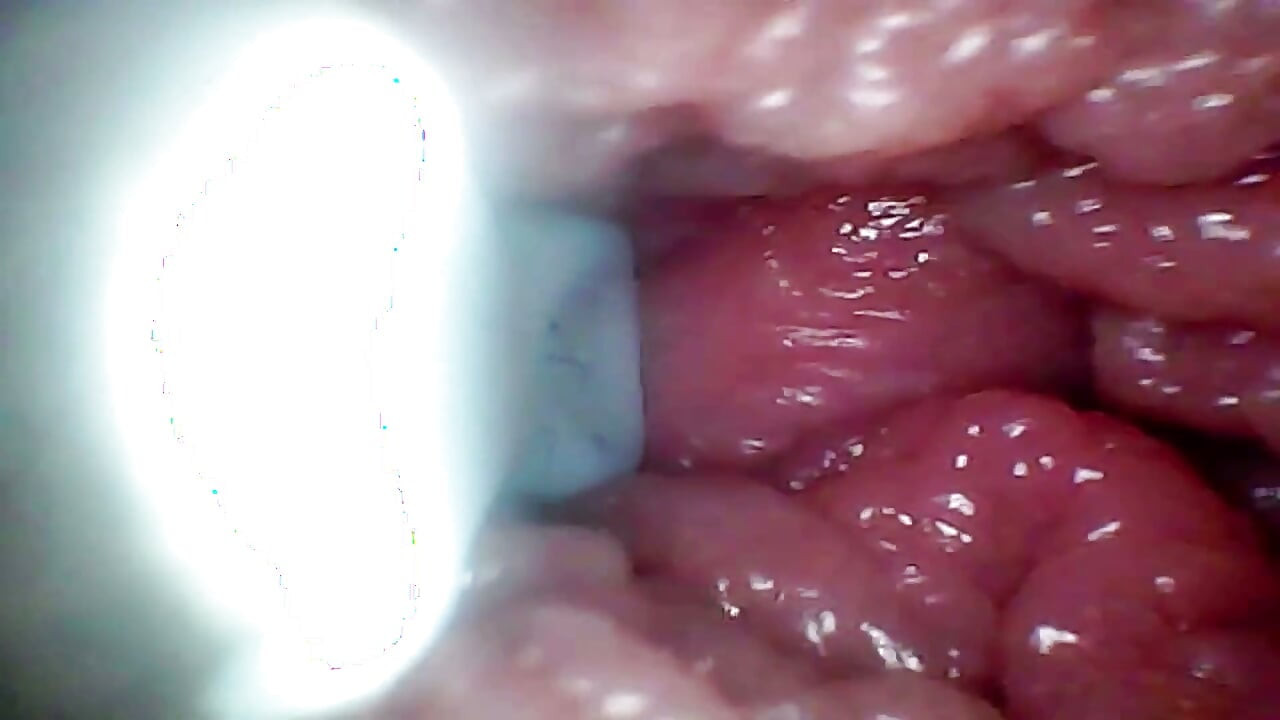 Une Caméra Endoscopique Enregistre Le Point G De Ma Femme. Vidéo Éducative, Gros Plan