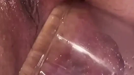 Aşırı anal vakum pompası eğitimi 2025