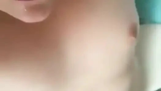 Девушка-ампутантка показывает свое тело