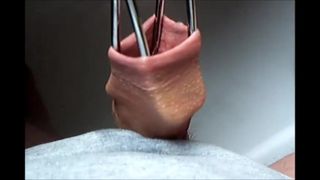 Foreskin - vídeo de 3 minutos