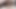 ぽっちゃり系肛門穴拡張