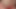 とてもイライラしています