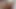 Lizzy Yum SD August 2025 Dilating #71