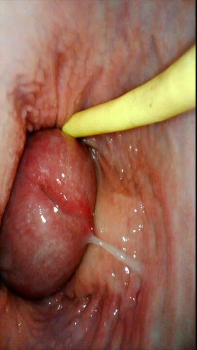 Servant girl do everything I say endoscope in pussy and creampie