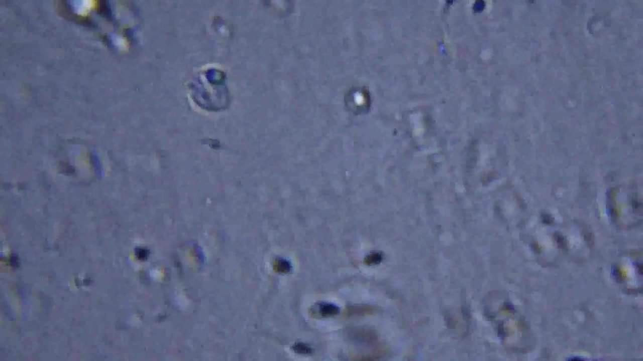 semen examination