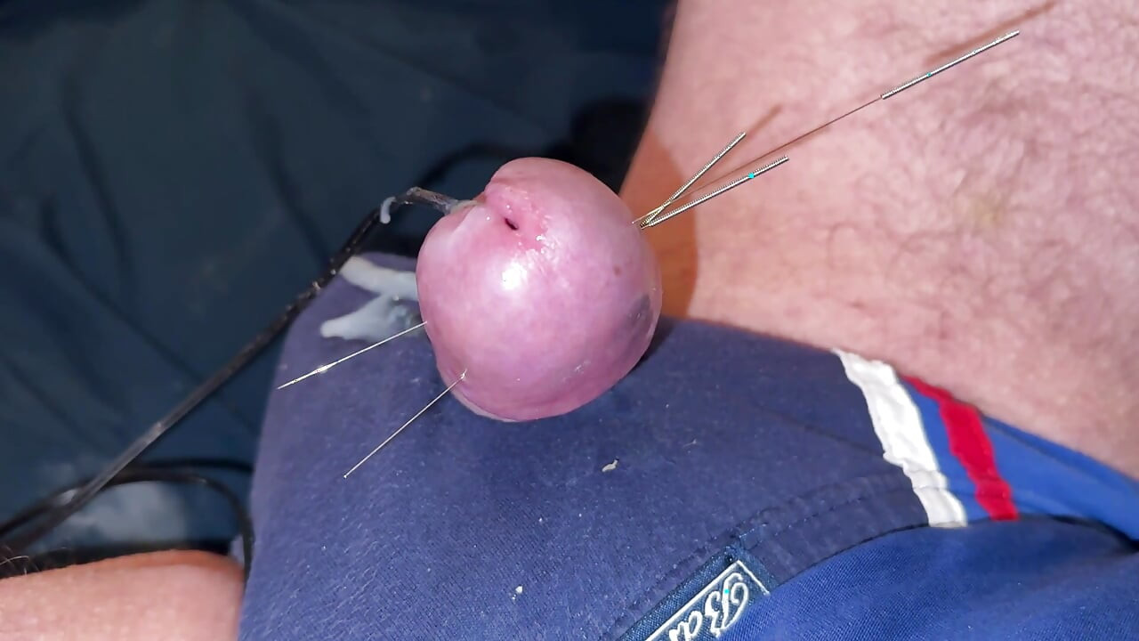 Βελόνες και σπέρμα