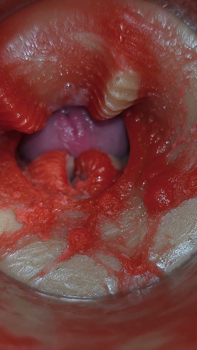 Camera Inside Deep Pussy Captures Very Huge Ejaculation of Sperm ASMR | Clip 1