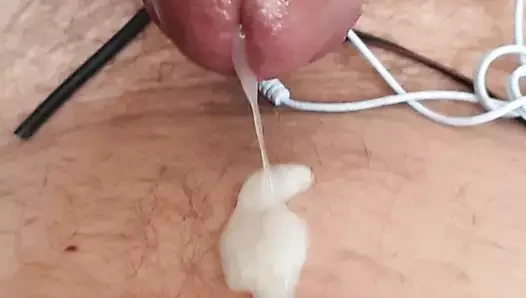 Estim boşalma
