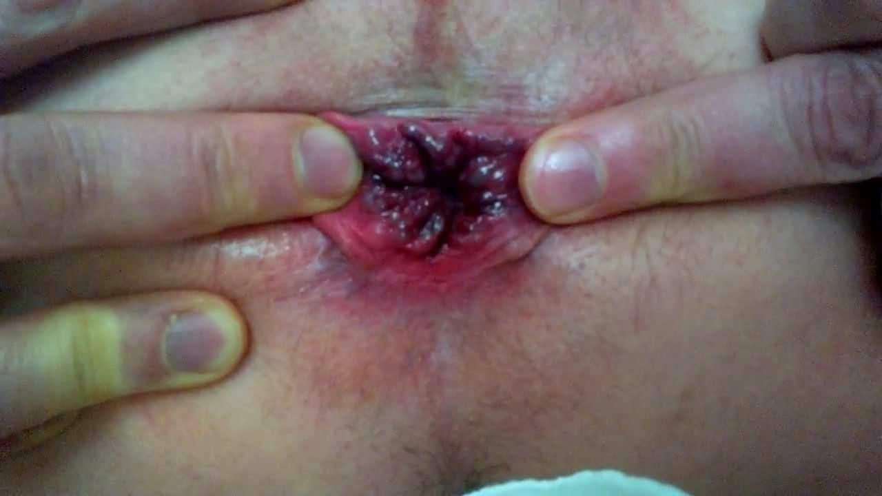 Anal self play