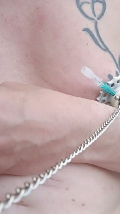 6 needles through the nipples stretched by plastic flower ring with holes on the terrace outside | Clip 1