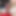 深い尿管サウンディング。女王様