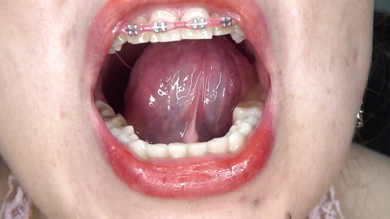 Swallowing Large Gummy Bears, Putting Them in the Vagina