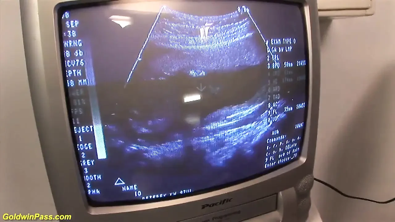 Redhead preggo fucked at the clinic