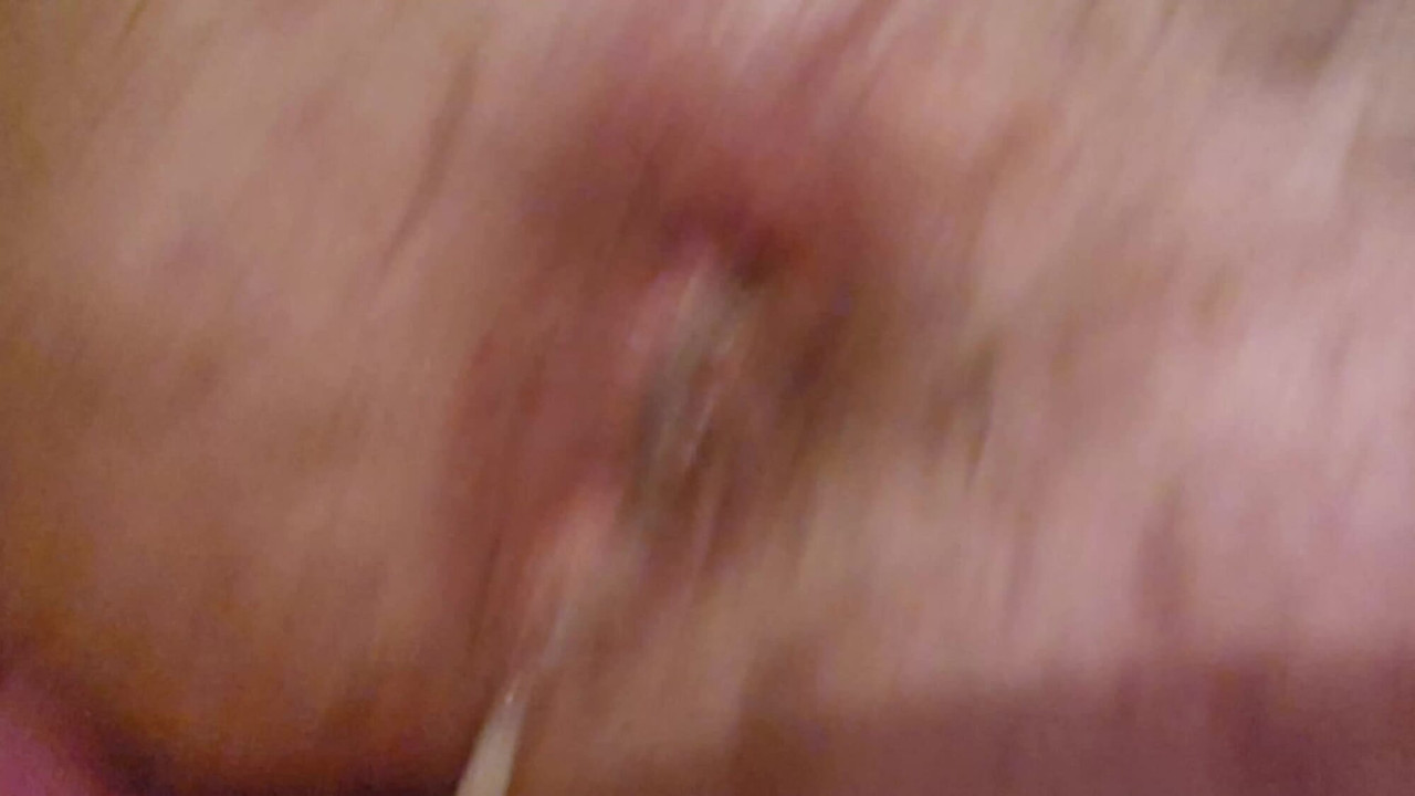 My ass after a very large deposiit