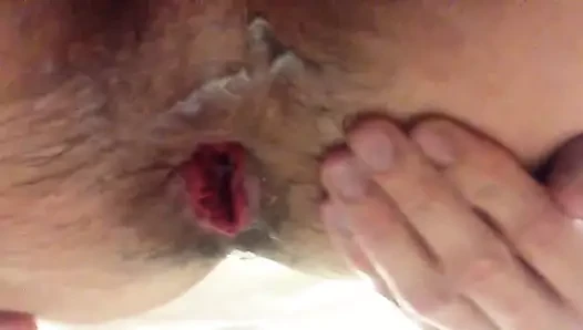 Self fisting