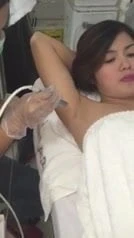 armpit treatment 1