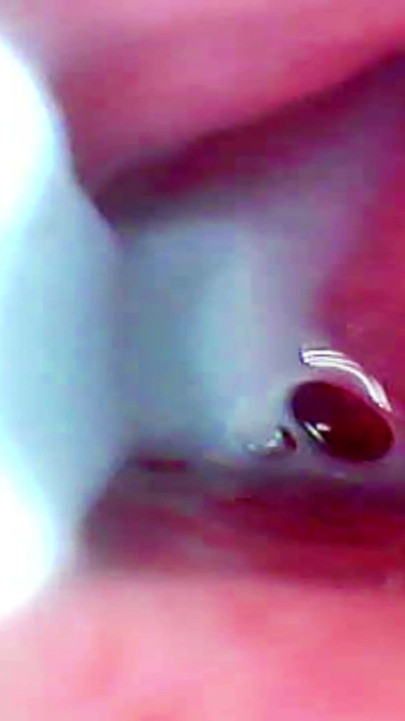 Camera deep inside records female orgasm | Clip 1