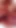 Close Up of my destroyed asshole.