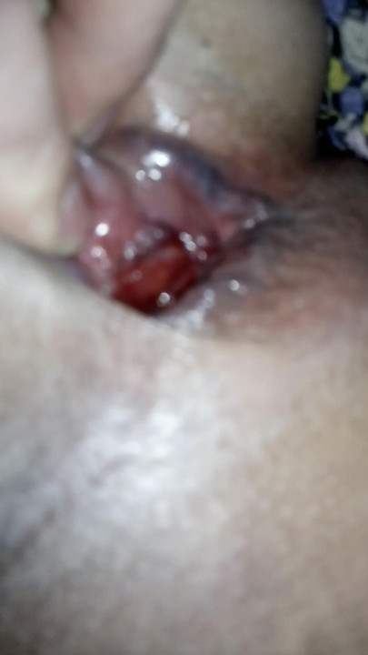 我的屁股