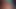 アナルドクター