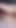 İçinde parmaklar sperm derlemesinin büyük bölümlerini buluyor | Klip 1