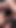 指と拡張器が彼のペニスに入っている | クリップ 1