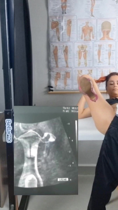הנבגד, האישה והגינקולוג שובבים באולטרסאונד! | קליפ 1