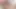 Lizzy Yum november 2023 electroshock #5 Post Op Orgasm Pussy masturbation teasing