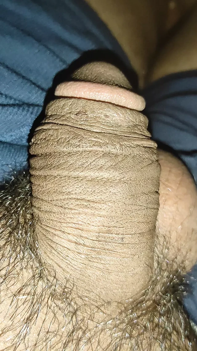 Dick