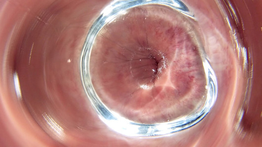 Anal inside look through the glass plug