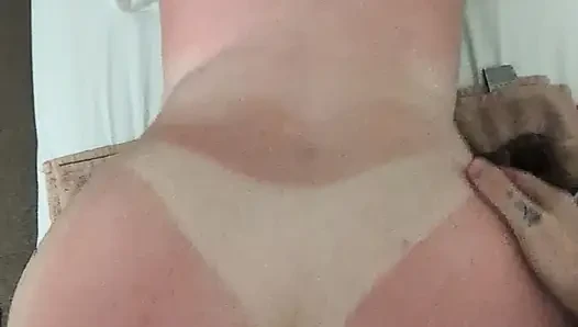 Обожженная солнцем раком