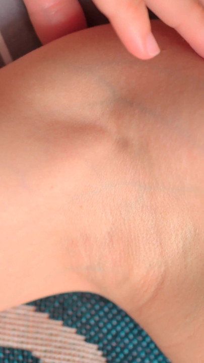 The Skin of My Armpits Is so Delicate