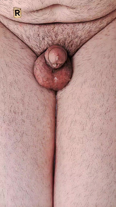 My wet penis is urinating."