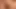Prostate orgasm