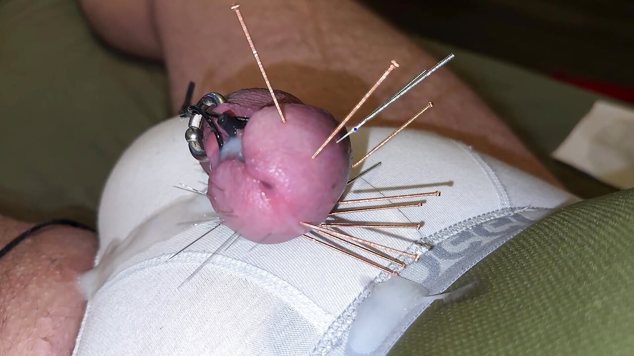 Acupuncture - Orgasm!