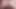 ニッキー・シン・ロング・アナル