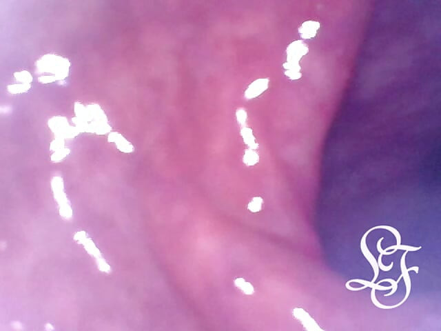 Exploring the Depths of my Ass with the Minicam!